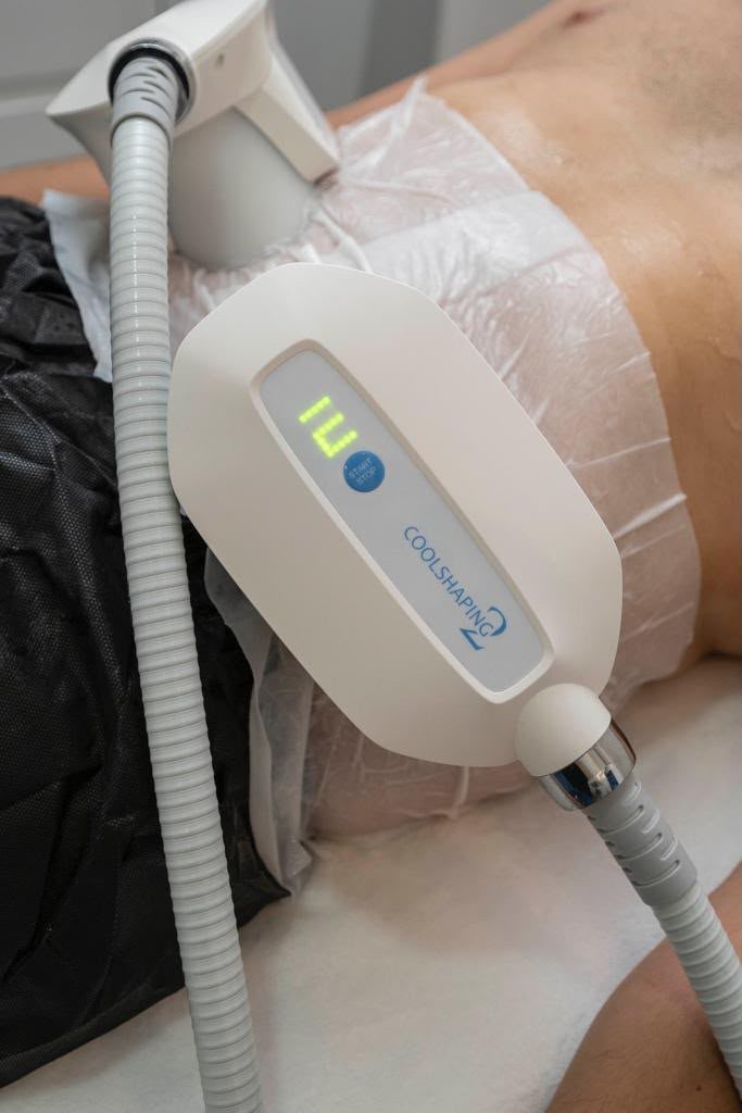 Aplicador de criolipólisis Coolshaping sobre el abdomen de un paciente